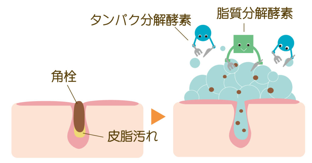 タンパク分解酵素、脂質分解酵素が角栓、皮脂汚れを分解しているイメージ