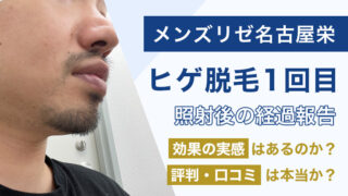 メンズリゼ名古屋栄院の体験レビュー。ヒゲ脱毛1回目、悪い評判、口コミは本当か?