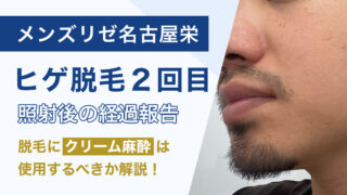 【医療脱毛】ヒゲ脱毛2回目をメンズリゼ名古屋栄で施術！脱毛にクリーム麻酔は使用するべきか経験をもとに解説！